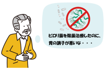ピロリ菌除菌後に胃の調子が悪いのはなぜ？考えられる原因とアフターフォローの重要性のアイキャッチ画像