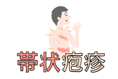 「ただの湿疹」じゃない！帯状疱疹の激痛・後遺症を防ぐ「免疫ケア」と「72時間の鉄則」のアイキャッチ画像