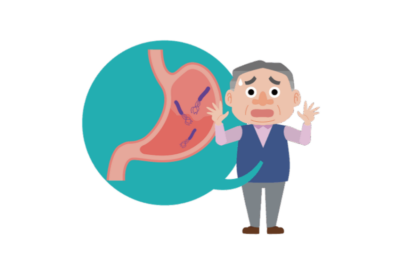 胃痛や胃もたれの原因？「ピロリ菌」の基本から除菌治療まで徹底解説のアイキャッチ画像