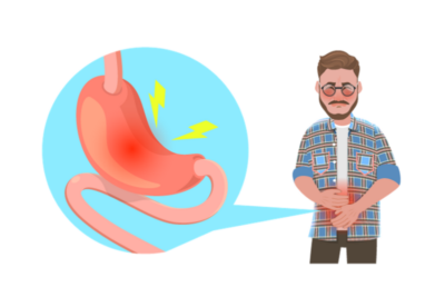 治らない胃もたれや腹痛の原因は「萎縮性胃炎」かも？放置してはいけない胃のサインのアイキャッチ画像