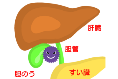 胆管炎とは？症状・原因・治療法を医師が解説｜発熱・黄疸・腹痛は危険なサインのアイキャッチ画像