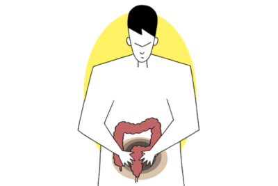 見逃されやすい消化器がん3選 ― 大腸がん・胃がん・膵がんを消化器内科医が解説のアイキャッチ画像