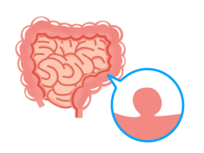 大腸ポリープができやすい人の特徴 ― 大腸カメラを受けるべき方とはのアイキャッチ画像