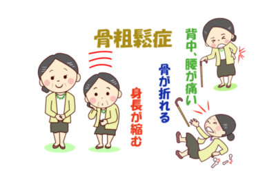 骨粗鬆症による骨折リスクと予防|骨密度検査から治療までのアイキャッチ画像