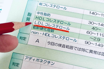 脂質異常症で食べてはいけないものと食べていいもの一覧|コレステロール管理の食事法のアイキャッチ画像