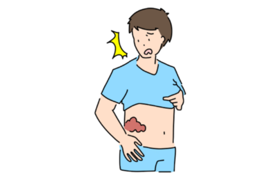 帯状疱疹はうつる？家族への感染リスクと正しい予防法を内科医が解説のアイキャッチ画像