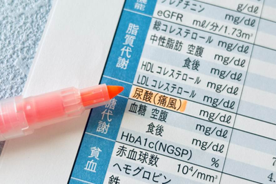 尿酸値を下げる食べ物・飲み物一覧|痛風予防のための食事管理ガイドのアイキャッチ画像